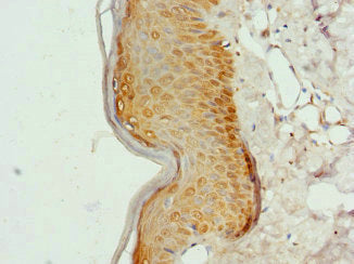 Immunohistochemistry of paraffin-embedded human skin tissue using COL9A3 Antibody at dilution of 1:100Rabbit anti-Human COL9A3 Polyclonal Antibody