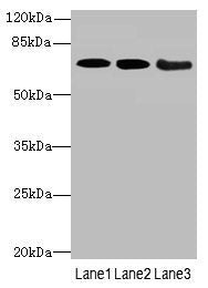 Western blot | All lanes: COL9A3antibody at 3.66μg/ml | Lane 1: K562 whole cell lysate | Lane 2: MCF-7 whole cell lysate | Lane 3: A549 whole cell lysate | Secondary | Goat polyclonal to rabbit IgG at 1/10000 dilution | Predicted band size: 64 kDa | Observed band size: 64 kDaRabbit anti-Human COL9A3 Polyclonal Antibody