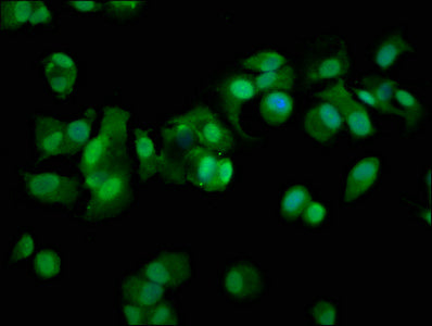 Immunofluorescence staining of MCF-7 cells with PSMD11 Antibody at 1:100, counter-stained with DAPI. The cells were fixed in 4% formaldehyde, permeabilized using 0.2% Triton X-100 and blocked in 10% normal Goat Serum. The cells were then incubated with the antibody overnight at 4°C. The secondary antibody was Alexa Fluor 488-congugated AffiniPure Goat Anti-Rabbit IgG(H+L).Rabbit anti-Human PSMD11 Polyclonal Antibody