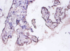 Immunohistochemistry of paraffin-embedded human placenta tissue using PSMD11 Antibody at dilution of 1:100Rabbit anti-Human PSMD11 Polyclonal Antibody