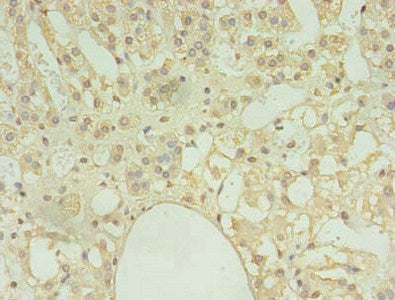 Immunohistochemistry of paraffin-embedded human adrenal gland tissue using COPB1 Antibody at dilution of 1:100Rabbit anti-Human COPB1 Polyclonal Antibody