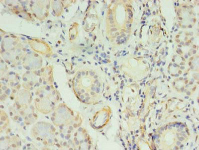 Immunohistochemistry of paraffin-embedded human pancreatic tissue using COPB1 Antibody at dilution of 1:100Rabbit anti-Human COPB1 Polyclonal Antibody