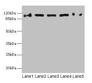Western blot  | All lanes: COPB1 antibody at 1µg/ml  | Lane 1: Hela whole cell lysate  | Lane 2: Jurkat whole cell lysate  | Lane 3: NIH/3T3 whole cell lysate  | Lane 4: Mouse liver tissue  | Lane 5: A549 whole cell lysate  | Secondary  | Goat polyclonal to rabbit IgG at 1/10000 dilution  | Predicted band size: 108 kDa  | Observed band size: 108 kDaRabbit anti-Human COPB1 Polyclonal Antibody