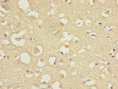 Immunohistochemistry of paraffin-embedded human brain tissue using COPZ1 Antibody at dilution of 1:100Rabbit anti-Human COPZ1 Polyclonal Antibody
