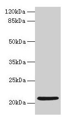 Western blot  | All lanes: COPZ1 antibody at 1µg/ml + K562 whole cell lysate  | Secondary  | Goat polyclonal to rabbit IgG at 1/10000 dilution  | Predicted band size: 21, 15, 18, 22, 19 kDa  | Observed band size: 21 kDaRabbit anti-Human COPZ1 Polyclonal Antibody