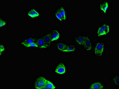 Immunofluorescent analysis of HepG2 cells using CORO1A Antibody at dilution of 1:100 and Alexa Fluor 488-congugated AffiniPure Goat Anti-Rabbit IgG(H+L)Rabbit anti-Human CORO1A Polyclonal Antibody