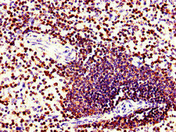 Immunohistochemistry of paraffin-embedded human spleen tissue using CORO1A Antibody at dilution of 1:100Rabbit anti-Human CORO1A Polyclonal Antibody