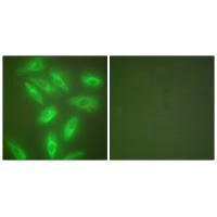 Immunofluorescence analysis of HeLa cells, using Keratin 18 antibody.