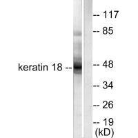 Western blot analysis of extracts from HeLa cells, using Keratin 18 antibody.