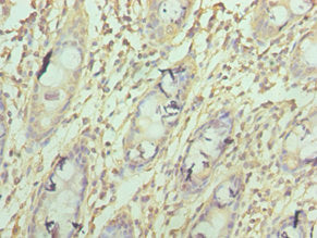 Immunohistochemistry of paraffin-embedded human colon tissue using COX4I1 Antibody at dilution of 1:100Rabbit anti-Human COX4I1 Polyclonal Antibody