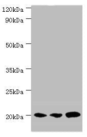 Western blot  | All lanes: COX4I1 antibody at 5µg/ml  | Lane 1: MCF-7 whole cell lysate  | Lane 2: A549 whole cell lysate  | Lane 3: HepG2 whole cell lysate  | Secondary  | Goat polyclonal to rabbit IgG at 1/10000 dilution  | Predicted band size: 20 kDa  | Observed band size: 20 kDaRabbit anti-Human COX4I1 Polyclonal Antibody