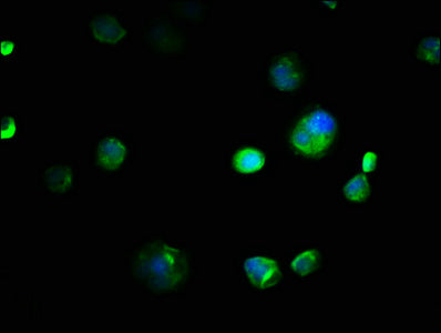 Immunofluorescence staining of MCF-7 cells with the antibody at 1:133, counter-stained with DAPI. The cells were fixed in 4% formaldehyde, permeabilized using 0.2% Triton X-100 and blocked in 10% normal Goat Serum. The cells were then incubated with the antibody overnight at 4°C. The secondary antibody was Alexa Fluor 488-congugated AffiniPure Goat Anti-Rabbit IgG(H+L).Rabbit anti-Human EMC8 Polyclonal Antibody