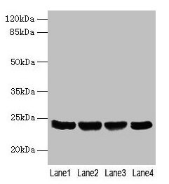 Western blot  | All lanes: EMC8 antibody at 4µg/ml  | Lane 1: A549 whole cell lysate  | Lane 2: Human placenta tissue  | Lane 3: Hela whole cell lysate  | Lane 4: HT29 whole cell lysate  | Secondary  | Goat polyclonal to rabbit IgG at 1/10000 dilution  | Predicted band size: 24, 14 kDa  | Observed band size: 24 kDaRabbit anti-Human EMC8 Polyclonal Antibody