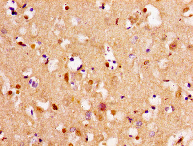 Immunohistochemistry of paraffin-embedded human brain tissue using TPMT Antibody at dilution of 1:100Rabbit anti-Human TPMT Polyclonal Antibody