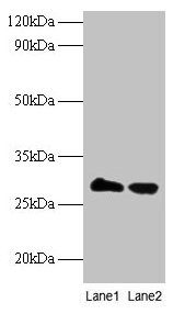 Western blot  | All lanes: TPMT antibody at 2µg/ml  | Lane 1: EC109 whole cell lysate  | Lane 2: 293T whole cell lysate  | Secondary  | Goat polyclonal to rabbit IgG at 1/15000 dilution  | Predicted band size: 29 kDa  | Observed band size: 29 kDaRabbit anti-Human TPMT Polyclonal Antibody