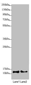 Western blot  | All lanes: COX7A2L antibody at 2.08µg/ml  | Lane 1: A549 whole cell lysate  | Lane 2: HepG2 whole cell lysate  | Secondary  | Goat polyclonal to rabbit IgG at 1/10000 dilution  | Predicted band size: 13 kDa  | Observed band size: 13 kDaRabbit anti-Human COX7A2L Polyclonal Antibody