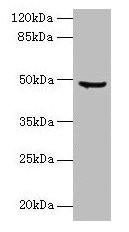 Western blot  | All lanes: CPA2 antibody at 1.5µg/ml + Hela whole cell lysate  | Secondary  | Goat polyclonal to rabbit IgG at 1/10000 dilution  | Predicted band size: 48 kDa  | Observed band size: 48 kDaRabbit anti-Human CPA2 Polyclonal Antibody