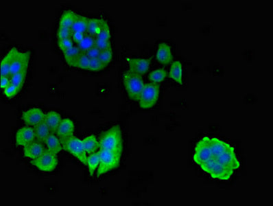 Immunofluorescent analysis of PC-3 cells using CPB2 Antibody at dilution of 1:100 and Alexa Fluor 488-congugated AffiniPure Goat Anti-Rabbit IgG(H+L)Rabbit anti-Human CPB2 Polyclonal Antibody