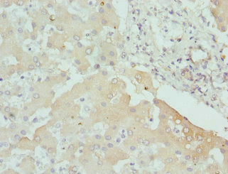 Immunohistochemistry of paraffin-embedded human liver tissue using CPN1 Antibody at dilution of 1:100Rabbit anti-Human CPN1 Polyclonal Antibody