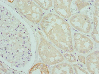 Immunohistochemistry of paraffin-embedded human kidney tissue using CPN1 Antibody at dilution of 1:100Rabbit anti-Human CPN1 Polyclonal Antibody