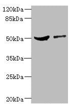Western blot  | All lanes: CPN1 antibody at 6.19µg/ml  | Lane 1: Mouse liver tissue  | Lane 2: MCF-7 whole cell lysate  | Secondary  | Goat polyclonal to rabbit IgG at 1/10000 dilution  | Predicted band size: 52 kDa  | Observed band size: 52 kDaRabbit anti-Human CPN1 Polyclonal Antibody