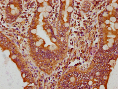 IHC image of CPNE3 Antibody diluted at 1:200 and staining in paraffin-embedded human small intestine tissue performed on a Leica BondTM system. After dewaxing and hydration, antigen retrieval was mediated by high pressure in a citrate buffer (pH 6.0). Section was blocked with 10% normal goat serum 30min at RT. Then primary antibody (1% BSA) was incubated at 4°C overnight. The primary is detected by a biotinylated secondary antibody and visualized using an HRP conjugated SP system.