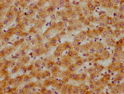 IHC image of CPNE3 Antibody diluted at 1:200 and staining in paraffin-embedded human liver tissue performed on a Leica BondTM system. After dewaxing and hydration, antigen retrieval was mediated by high pressure in a citrate buffer (pH 6.0). Section was blocked with 10% normal goat serum 30min at RT. Then primary antibody (1% BSA) was incubated at 4°C overnight. The primary is detected by a biotinylated secondary antibody and visualized using an HRP conjugated SP system.