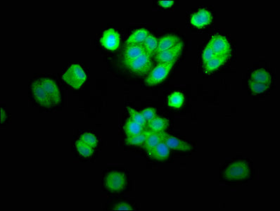 Immunofluorescence staining of HepG2 cells with CPOX Antibody at 1:100, counter-stained with DAPI. The cells were fixed in 4% formaldehyde, permeabilized using 0.2% Triton X-100 and blocked in 10% normal Goat Serum. The cells were then incubated with the antibody overnight at 4°C. The secondary antibody was Alexa Fluor 488-congugated AffiniPure Goat Anti-Rabbit IgG(H+L).Rabbit anti-Human CPOX Polyclonal Antibody
