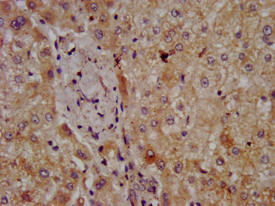 IHC image of CPOX Antibody diluted at 1:300 and staining in paraffin-embedded human liver tissue performed on a Leica BondTM system. After dewaxing and hydration, antigen retrieval was mediated by high pressure in a citrate buffer (pH 6.0). Section was blocked with 10% normal goat serum 30min at RT. Then primary antibody (1% BSA) was incubated at 4°C overnight. The primary is detected by a biotinylated secondary antibody and visualized using an HRP conjugated SP system.Rabbit anti-Human CPOX Polyclonal Antibody