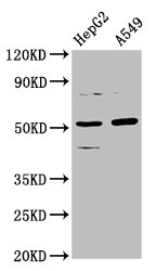 Western Blot  | Positive WB detected in: HepG2 whole cell lysate, A549 whole cell lysate  | All lanes: CPOX antibody at 5.7µg/ml  | Secondary  | Goat polyclonal to rabbit IgG at 1/50000 dilution  | Predicted band size: 51, 31 kDa  | Observed band size: 51 kDaRabbit anti-Human CPOX Polyclonal Antibody