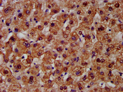 IHC image of CPS1 Antibody diluted at 1:300 and staining in paraffin-embedded human liver tissue performed on a Leica BondTM system. After dewaxing and hydration, antigen retrieval was mediated by high pressure in a citrate buffer (pH 6.0). Section was blocked with 10% normal goat serum 30min at RT. Then primary antibody (1% BSA) was incubated at 4°C overnight. The primary is detected by a biotinylated secondary antibody and visualized using an HRP conjugated SP system.Rabbit anti-Human CPS1 Polyclonal Antibody