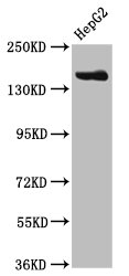 Western Blot  | Positive WB detected in: HepG2 whole cell lysate  | All lanes: CPS1 antibody at 3.8µg/ml  | Secondary  | Goat polyclonal to rabbit IgG at 1/50000 dilution  | Predicted band size: 165, 117, 166 kDa  | Observed band size: 165 kDaRabbit anti-Human CPS1 Polyclonal Antibody