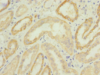 Immunohistochemistry of paraffin-embedded human kidney tissue using CPSF4 Antibody at dilution of 1:100Rabbit anti-Human CPSF4 Polyclonal Antibody