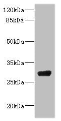 Western blot | All lanes: CPSF4 antibody IgG at 4.37μg/ml + 293T whole cell lysate | Secondary | Goat polyclonal to rabbit IgG at 1/10000 dilution | Predicted band size: 31, 28 kDa | Observed band size: 31 kDaRabbit anti-Human CPSF4 Polyclonal Antibody