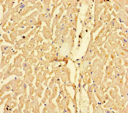 Immunohistochemistry of paraffin-embedded human heart tissue using CPT1A Antibody at dilution of 1:100Rabbit anti-Human CPT1A Polyclonal Antibody