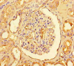 Immunohistochemistry of paraffin-embedded human kidney tissue using CPT1A Antibody at dilution of 1:100Rabbit anti-Human CPT1A Polyclonal Antibody
