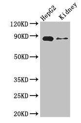 Western Blot | Positive WB detected in: HepG2 whole cell lysate, Mouse kidney tissue | All lanes: CPT1A antibody at 3.4μg/ml | Secondary | Goat polyclonal to rabbit IgG at 1/50000 dilution | Predicted band size: 89, 87 kDa | Observed band size: 89 kDaRabbit anti-Human CPT1A Polyclonal Antibody