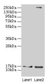Western blot  | All lanes: CRABP1 antibody at 4µg/ml  | Lane 1: Mouse eye tissue  | Lane 2: THP-1 whole cell lysate  | Secondary  | Goat polyclonal to rabbit IgG at 1/10000 dilution  | Predicted band size: 16 kDa  | Observed band size: 16 kDaRabbit anti-Human CRABP1 Polyclonal Antibody