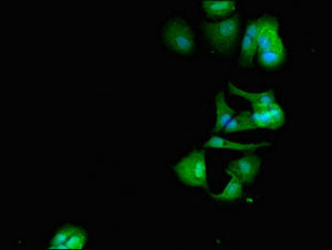 Immunofluorescent analysis of MCF-7 cells using CRCP Antibody at dilution of 1:100 and Alexa Fluor 488-congugated AffiniPure Goat Anti-Rabbit IgG(H+L)Rabbit anti-Human CRCP Polyclonal Antibody