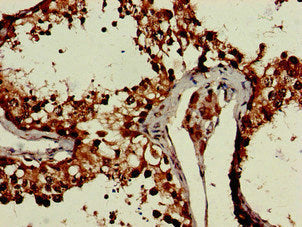 Immunohistochemistry of paraffin-embedded human testis tissue using CRCP Antibody at dilution of 1:100Rabbit anti-Human CRCP Polyclonal Antibody