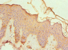 Immunohistochemistry of paraffin-embedded human skin tissue using CREB3 Antibody at dilution of 1:100Rabbit anti-Human CREB3 Polyclonal Antibody