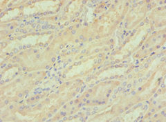 Immunohistochemistry of paraffin-embedded human kidney tissue using CREB3 Antibody at dilution of 1:100Rabbit anti-Human CREB3 Polyclonal Antibody