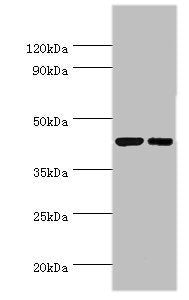 Western blot | All lanes: Cyclic AMP-responsive element-binding protein 3 antibody at 6μg/ml | Lane 1: Jurkat whole cell lysate | Lane 2: HepG2 whole cell lysate | Secondary | Goat polyclonal to rabbit IgG at 1/10000 dilution | Predicted band size: 44, 42, 40 kDa | Observed band size: 44 kDaRabbit anti-Human CREB3 Polyclonal Antibody