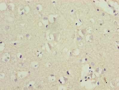 Immunohistochemistry of paraffin-embedded human brain tissue using CRHR1 Antibody at dilution of 1:100Rabbit anti-Human CRHR1 Polyclonal Antibody