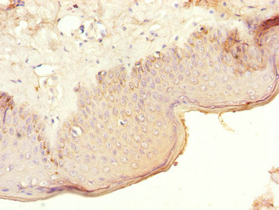 Immunohistochemistry of paraffin-embedded human skin tissue using CRHR1 Antibody at dilution of 1:100Rabbit anti-Human CRHR1 Polyclonal Antibody