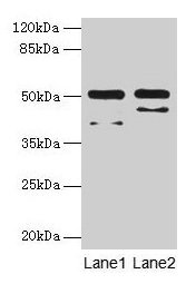Western blot  | All lanes: CRHR1 antibody at 16µg/ml  | Lane 1: Hela whole cell lysate  | Lane 2: HL60 whole cell lysate  | Secondary  | Goat polyclonal to rabbit IgG at 1/10000 dilution  | Predicted band size: 51, 48, 44, 47, 29 kDa  | Observed band size: 51 kDaRabbit anti-Human CRHR1 Polyclonal Antibody