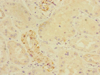 Immunohistochemistry of paraffin-embedded human kidney tissue using CRIP1 Antibody at dilution of 1:100Rabbit anti-Human CRIP1 Polyclonal Antibody