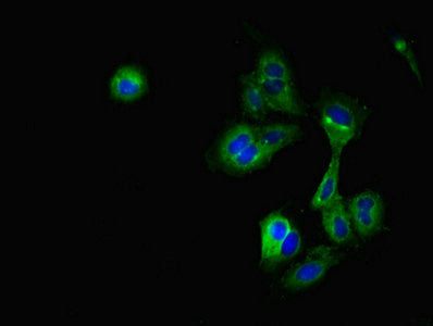 Immunofluorescent analysis of Hela cells using CRIP2 Antibody at dilution of 1:100 and Alexa Fluor 488-congugated AffiniPure Goat Anti-Rabbit IgG(H+L)Rabbit anti-Human CRIP2 Polyclonal Antibody