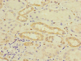 Immunohistochemistry of paraffin-embedded human kidney tissue using CRIP2 Antibody at dilution of 1:100Rabbit anti-Human CRIP2 Polyclonal Antibody