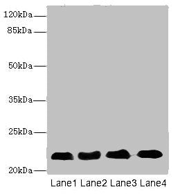 Western blot  | All lanes: CRIP2 antibody at 5.93µg/ml  | Lane 1: Rat heart tissue  | Lane 2: Mouse lung tissue  | Lane 3: Hela whole cell lysate  | Lane 4: MCF-7 whole cell lysate  | Secondary  | Goat polyclonal to rabbit IgG at 1/10000 dilution  | Predicted band size: 23, 31 kDa  | Observed band size: 23 kDaRabbit anti-Human CRIP2 Polyclonal Antibody